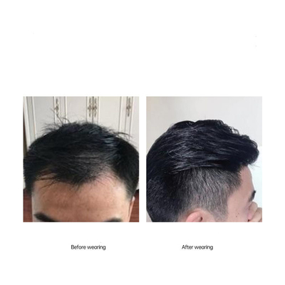 全手製 滑らかな背筋型 ヘアライン 100% 人間の髪の代わり トゥーピー 男性用